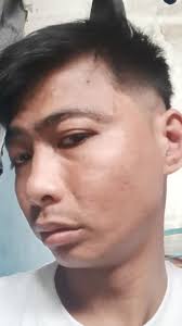 Bells palsy pa, Haayyys