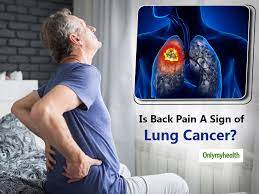 We know it's a worrying time for people with cancer, we have. What Is The Correlation Between Back Pain And Lung Cancer