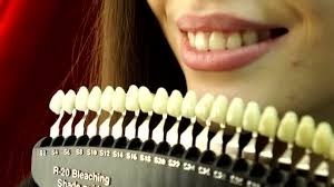 close up patient and tooth color chart young woman smiling effective teeth whitening