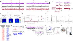 First off they are great quality. Coupling Of Hippocampal Theta And Ripples With Pontogeniculooccipital Waves Nature