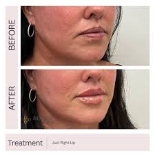 Nectar Aesthetics Med Spa