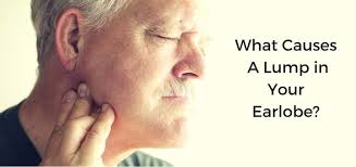 8 Causes Treatments For Lump In Earlobe Daily Health Cures Treatment The Cure Person