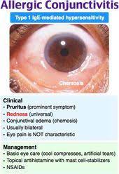 Allergic Conjunctivitis Nurse Practioner Medical Mnemonics Nursing Mnemonics