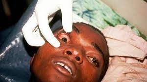 Now the cell has unknowingly become a virus factory. Uganda Ends Marburg Virus Disease Outbreak Business Post Nigeria
