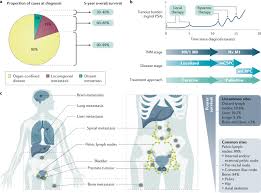 Growths in the prostate can be benign (not cancer) or. Prostate Cancer Nature Reviews Disease Primers