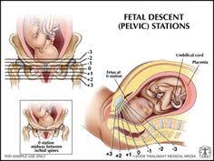 stages of labor