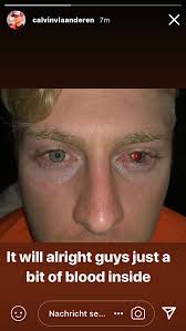 images?q=tbn:ANd9GcRjKgw3Thb5yWdfwEvZ-JW