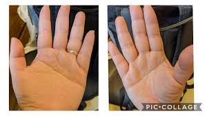 Some famous people who have simian lines include,, tony blair, nikita kruchev and john steinbeck. 35f Right Dominant Double Simian Line Pretty Cool Bc 3 Members Including Me Of Our Family Have Double Simian Lines I Know The Basics Of Heart And Head Being One Any