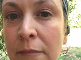 Fundraiser by Tina ONeill : Help for a mom medical incident