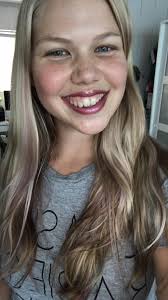 Just to let others know. I went to the dentist a few days ago for a check  and clean. Within the hour I showed signs of being glutoned. Turns out the  polish