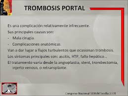 Thrombosis is the formation of a blood clot inside a blood vessel, obstructing the flow of blood through the circulatory system. Revisin Del Tema Complicaciones Vasculares A Heptica Trombosis