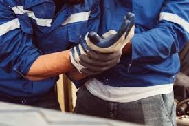 Image result for Hand Injury