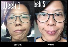 Check spelling or type a new query. Before After Photos Sunday Seeds