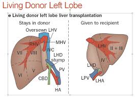 It is a large organ, with its major lobe occupying the right side of the abdomen below the diaphragm, while the narrower left lobe extends all. Liver Living Donor Uw Ultrasound