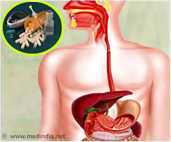 Maternal Use Of The Ssri Antidepressant Fluoxetine Linked To Fatty Liver