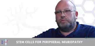 Although many neuropathies have no known causes, neuropathy is often associated with another condition. Stem Cells For Peripheral Neuropathy Polyneuropathy