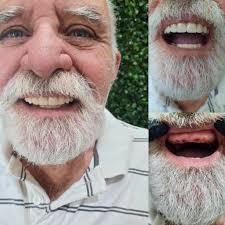 Buenas gente! Me ayudarían poniendo puntitos en la publicación para que no  se pierda y así poder llegar a más personas 🙏🏻 Este mes estoy haciendo  PROMOS EN ARAÑITAS PROTESIS COMPLETAS con