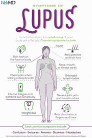 Medschool Doctor Medicalstudent Medicalschool Resources Step1 Study Inspiration School Tips Lupus Facts Medical Knowledge Lupus Symptoms