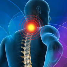 Image result for Neck Pain