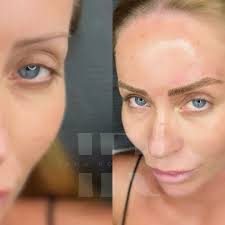 Cuando realizo un trabajo de micropigmentación de cejas, da igual la  técnica que utilice, debo elegir bien la aguja con la que voy a trabajar,  los pigmentos, diseño, velocidad de la máquina…etc..todo