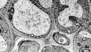 (resolution is the degree of sharpness of an image.) figure 2 compares the magnification of a light microscope to that of a tem. Electron Micrograph Of Cell Walls In The Cell Vacuolization Region Just Download Scientific Diagram