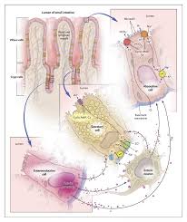 Image result for Chronic Diarrhea