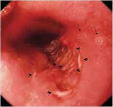 Clinical guidelines of the russian gastroenterological association. Viral Infections Nutrition Guide Karel S Nutrition Blog