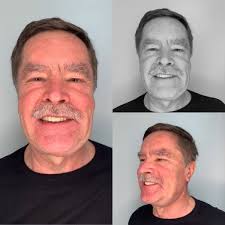 Dr. Gabor Tamas Pinter Md Dmd