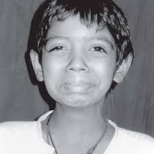 PDF) Ochoa or Urofacial Syndrome