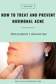 If your hormones are imbalanced with the female hormones such as estrogen and progesterone, this will lead to your body overproducing. The Ultimate Guide To Dealing With Hormonal Acne