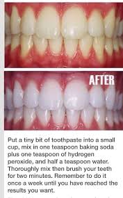 Pin On Diy Teeth Whitening