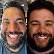 Dr. Chase Carlson (@dmd.carlson) • Instagram photos and videos