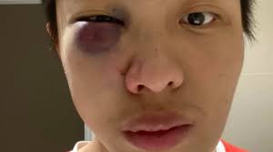 Jonathan Mok: Boy, 15, guilty over racist Covid attack in West End