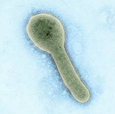 En el comunicado publicado por las autoridades sanitarias del país apuntan a que el caso del virus de marburgo fue diagnosticado el 3 de agosto, y fue confirmado por el instituto pasteur de dakar el día 9 de agosto. Virus De Marburg Gaz Wiki