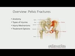 This is usually achieved using js templates like underscore templates, mustache, handlebars etc. Diagram Of Common Back Bone Break Low Back Pain Wikipedia Also Known As Ishikawa Or Cause And Effect Diagrams Veda Images