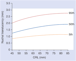 In case the nt scan indicates a risk of any abnormality (be it trisomy 13 or 18, or down syndrome), you should know that it doesn't necessarily mean that your baby actually has. Screening For Fetal Abnormality In The First And Second Trimesters Content Last Reviewed 15th March 2020 Chapter 7 High Risk Pregnancy