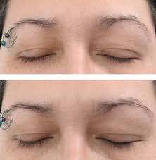 See the results submitted by actual clients who have used rapidlash® products; Before And After Rapidlash This West Coast Mommy