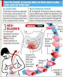 It is a disease in which cells grow abnormally and have. Signs Of Bladder Cancer Archives Safemedtrip Com