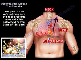 These are the muscles on either side of your rectus abdominis if you can't, your core muscles are weak, you haven't learned how to engage and brace them, or perhaps you have a picture everything from your rib cage to your pelvis: Referred Pain Around The Shoulder Everything You Need To Know Dr Nabil Ebraheim Youtube