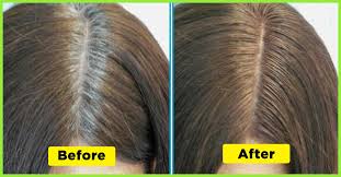 With old age, usually, the melanocytes slowly stop producing the melanin responsible for hair coloring. Hair Color How To Color Grey Hair Naturally With Nutmeg