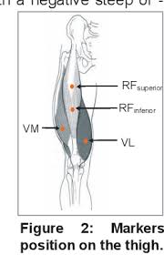 Making accurate free body diagrams for a system of blocks connected by string and pulleys is an important step towards writing the correct equations of. Effects Of Lower Body Compression Garment In Muscle Oscillation And Tissular Injury During Intense Exercise Semantic Scholar
