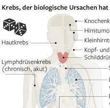 Bauchspeicheldruse Diese Diagnose Ist Ihr Todesurteil Fast Immer Welt