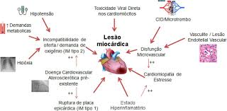 Purtroppo in molti casi di miocardite ecg ed ecocardiogramma basali non risulterebbero predittivi di tossicità e comunque normali nella quasi totalità dei casi. Doenca De Coronavirus 19 E O Miocardio