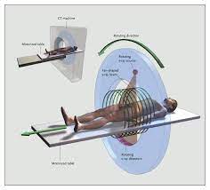 2 why is intermountain measuring and largely due to this increase in medical radiation exposure, the u.s. Computed Tomography An Increasing Source Of Radiation Exposure Nejm