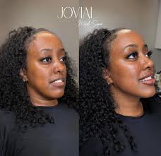 Jovialmedspa (@jovialmedspa) · Philadelphia, PA