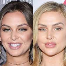 Not to keep moaning about Lala's face, but this just makes me so sad! 2016  vs 2019. So much unnecessary filler! : r/vanderpumprules