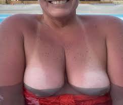 A little too much sun?? nudes by Flsunkat