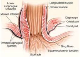Hsv shows punched out ulcers in esophagus. Esophagitis Ganguly Flashcards Quizlet