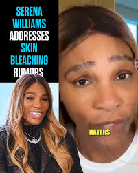 "No, for you haters out there, I do not bleach my skin"