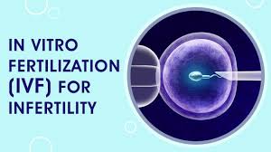 Intrauterine insemination or iui procedure can be considered the start of the fertility treatment process. Intrauterine Insemination Iui Process For Infertility Treatment Youtube